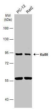 Various whole cell extracts (30 μg) were separated by 7.5% SDS-PAGE, and the membrane was blotted with Ku80 antibody [N3C2], Internal (GTX109935) diluted at 1:1000. The HRP-conjugated anti-rabbit IgG antibody (GTX213110-01) was used to detect the primary antibody.