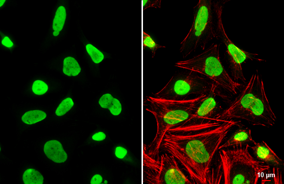 Ku80 antibody [N3C2], Internal detects Ku80 protein at nucleus by immunofluorescent analysis. Sample: HeLa cells were fixed in 4% paraformaldehyde at RT for 15 min. Green: Ku80 stained by Ku80 antibody [N3C2], Internal (GTX109935) diluted at 1:1000. Red: phalloidin, a cytoskeleton marker, diluted at 1:200. Scale bar= 10 μm.