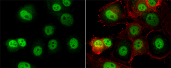 O-GlcNAc transferase antibody detects O-GlcNAc transferase protein at cytoplasm and nucleus by immunofluorescent analysis. Sample: MCF7 cells were fixed in 4% paraformaldehyde at RT for 15 min. Green: O-GlcNAc transferase protein stained by O-GlcNAc transferase antibody (GTX109939) diluted at 1:500. Red: phalloidin, a cytoskeleton marker, stained by phalloidin (invitrogen, A12380) diluted at 1:200.