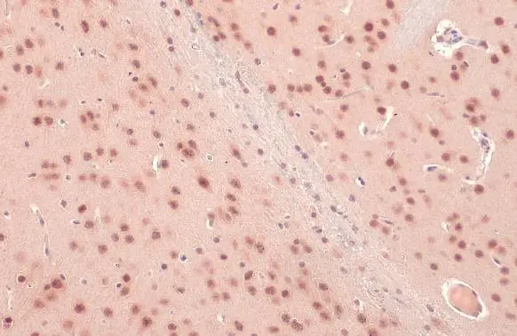 O-GlcNAc transferase antibody detects O-GlcNAc transferase protein at cytoplasm and nucleus by immunohistochemical analysis. Sample: Paraffin-embedded rat brain. O-GlcNAc transferase stained by O-GlcNAc transferase antibody (GTX109939) diluted at 1:500. Antigen Retrieval: Citrate buffer, pH 6.0, 15 min
