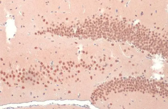 O-GlcNAc transferase antibody detects O-GlcNAc transferase protein at cytoplasm and nucleus by immunohistochemical analysis. Sample: Paraffin-embedded mouse brain. O-GlcNAc transferase stained by O-GlcNAc transferase antibody (GTX109939) diluted at 1:500. Antigen Retrieval: Citrate buffer, pH 6.0, 15 min