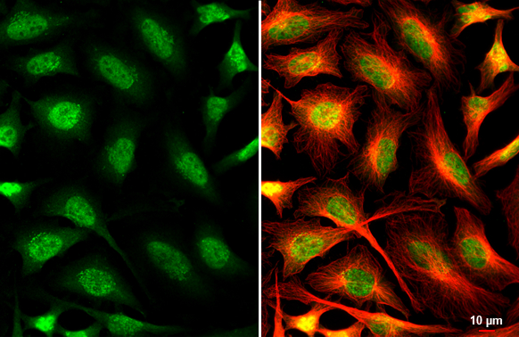 O-GlcNAc transferase antibody detects O-GlcNAc transferase protein at nucleus by immunofluorescent analysis. Sample: HeLa cells were fixed in 4% paraformaldehyde at RT for 15 min. Green: O-GlcNAc transferase stained by O-GlcNAc transferase antibody (GTX109939) diluted at 1:500. Red: alpha Tubulin, a cytoskeleton marker, stained by alpha Tubulin antibody [GT114] (GTX628802) diluted at 1:1000. Scale bar= 10μm.