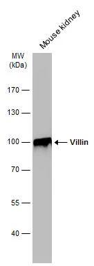 Mouse tissue extract (50 μg) was separated by 7.5% SDS-PAGE, and the membrane was blotted with Villin antibody (GTX109940) diluted at 1:1000. The HRP-conjugated anti-rabbit IgG antibody (GTX213110-01) was used to detect the primary antibody.