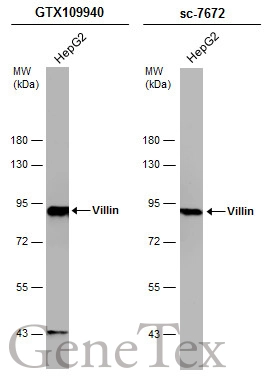 Whole cell extract (30 μg) was separated by 7.5% SDS-PAGE, and the membranes were blotted with Villin antibody (GTX109940) diluted at 1:5000 and competitor's antibody (sc-7672) diluted at 1:100. The HRP-conjugated anti-rabbit IgG antibody (GTX213110-01) was used to detect the primary antibody.