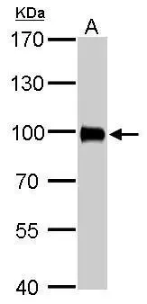 Villin antibody detects VIL1 protein by western blot analysis. A. 50 μg rat kidney lysate/extract 7.5% SDS-PAGE Villin antibody (GTX109940) dilution: 1:2000 The HRP-conjugated anti-rabbit IgG antibody (GTX213110-01) was used to detect the primary antibody.