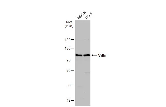 Various whole cell extracts (30 μg) were separated by 7.5% SDS-PAGE, and the membrane was blotted with Villin antibody (GTX109940) diluted at 1:500. The HRP-conjugated anti-rabbit IgG antibody (GTX213110-01) was used to detect the primary antibody.