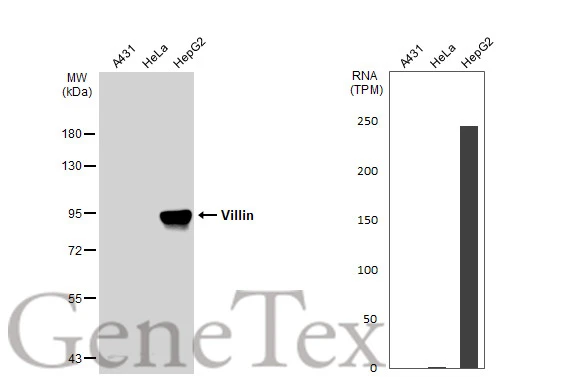 Various whole cell extracts (30 μg) were separated by 7.5% SDS-PAGE, and the membrane was blotted with Villin antibody (GTX109940) diluted at 1:2000. The HRP-conjugated anti-rabbit IgG antibody (GTX213110-01) was used to detect the primary antibody. Corresponding RNA expression data for the same cell lines are based on Human Protein Atlas program.
