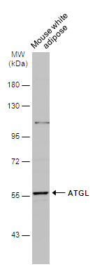 Mouse tissue extract (50 μg) was separated by 7.5% SDS-PAGE, and the membrane was blotted with ATGL antibody [N1C1] (GTX109941) diluted at 1:1000. The HRP-conjugated anti-rabbit IgG antibody (GTX213110-01) was used to detect the primary antibody.