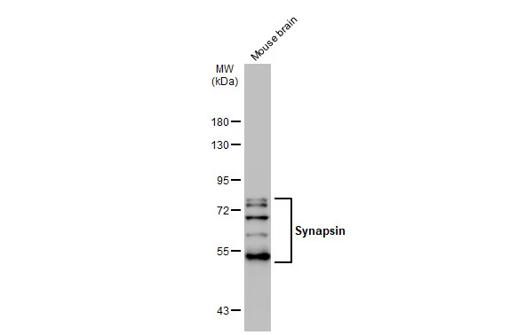 Mouse tissue extract (50 μg) was separated by 7.5% SDS-PAGE, and the membrane was blotted with Synapsin antibody (GTX109960) diluted at 1:1000. The HRP-conjugated anti-rabbit IgG antibody (GTX213110-01) was used to detect the primary antibody.