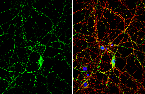 Synapsin antibody detects Synapsin protein by immunofluorescent analysis. Sample: DIV10 rat E18 primary cortical neuron cells were fixed in 4% paraformaldehyde at RT for 15 min. Green: Synapsin stained by Synapsin antibody (GTX109960) diluted at 1:500. Red: Tau, stained by Tau antibody [GT287] (GTX634809) diluted at 1:500. Blue: Fluoroshield with DAPI (GTX30920).