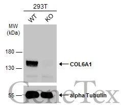Wild-type (WT) and COL6A1 knockout (KO) 293T cell extracts (30 μg) were separated by 7.5% SDS-PAGE, and the membrane was blotted with COL6A1 antibody [C1C2], Internal (GTX109963) diluted at 1:500. The HRP-conjugated anti-rabbit IgG antibody (GTX213110-01) was used to detect the primary antibody.