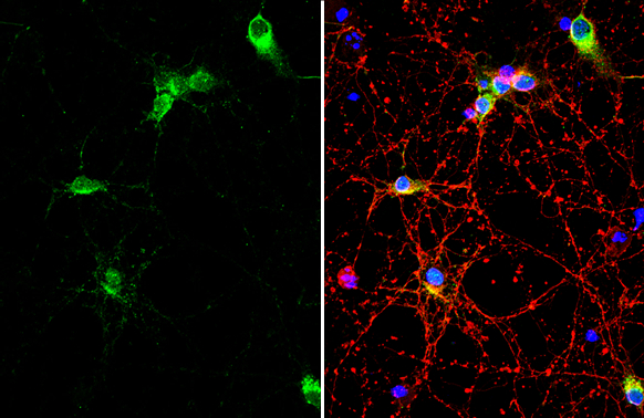 COL6A1 antibody [C1C2], Internal detects COL6A1 protein by immunofluorescent analysis. Sample: DIV10 rat E18 primary cortical neuron cells were fixed in 4% paraformaldehyde at RT for 15 min. Green: COL6A1 stained by COL6A1 antibody [C1C2], Internal (GTX109963) diluted at 1:500. Red: beta Tubulin 3/ Tuj1, stained by beta Tubulin 3/ Tuj1 antibody [GT11710] (GTX631836) diluted at 1:500. Blue: Fluoroshield with DAPI (GTX30920).