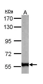 Sample (50 ug of whole cell lysate) A: mouse liver 7.5% SDS PAGE GTX109972 diluted at 1:1000