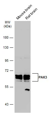 Various tissue extracts (50 μg) were separated by 7.5% SDS-PAGE, and the membrane was blotted with PAK3 antibody (GTX109991) diluted at 1:1000. The HRP-conjugated anti-rabbit IgG antibody (GTX213110-01) was used to detect the primary antibody.