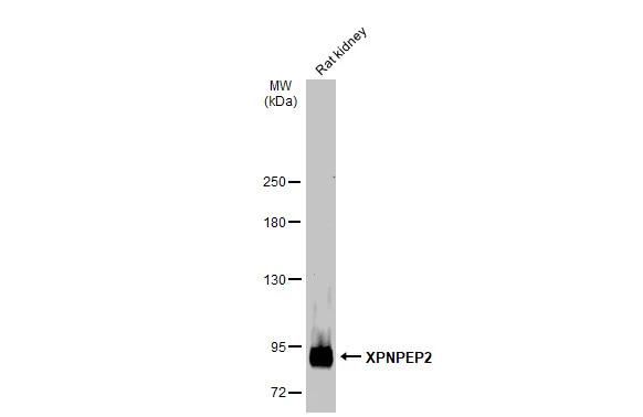 Rat tissue extract (50 μg) was separated by 5% SDS-PAGE, and the membrane was blotted with XPNPEP2 antibody [N3C3] (GTX109995) diluted at 1:1000. The HRP-conjugated anti-rabbit IgG antibody (GTX213110-01) was used to detect the primary antibody.