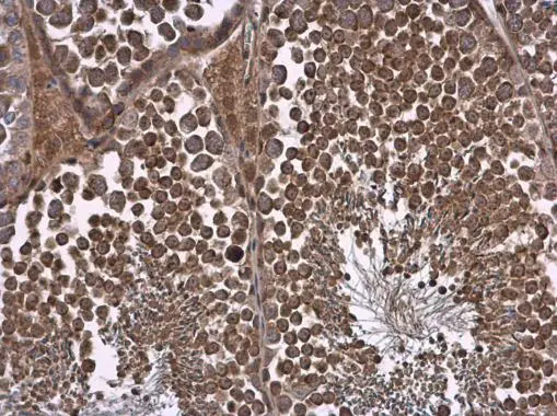 NPR-C antibody [N3C3] detects NPR-C protein at cell membrane and cytoplasm in mouse testis by immunohistochemical analysis. Sample: Paraffin-embedded mouse testis. NPR-C antibody [N3C3] (GTX110023) diluted at 1:500. 
 Antigen Retrieval: Citrate buffer, pH 6.0, 15 min
