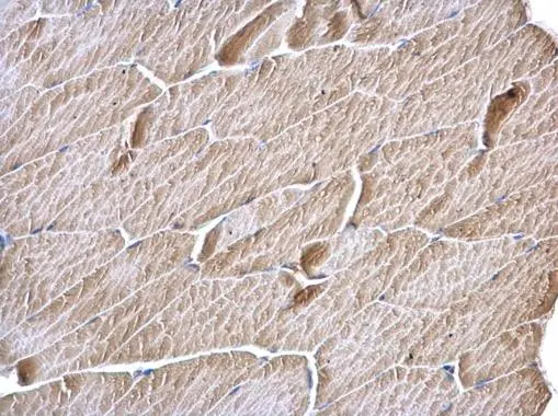 MCD antibody [N2C1], Internal detects MCD protein at cytosol on mouse muscle by immunohistochemical analysis. Sample: Paraffin-embedded mouse muscle. MCD antibody [N2C1], Internal (GTX110037) dilution: 1:500. 
 Antigen Retrieval: Trilogy? (EDTA based, pH 8.0) buffer, 15min