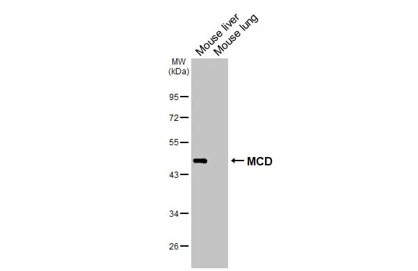 Various tissue extracts (50 μg) were separated by 10% SDS-PAGE, and the membrane was blotted with MCD antibody [N2C1], Internal (GTX110037) diluted at 1:500. The HRP-conjugated anti-rabbit IgG antibody (GTX213110-01) was used to detect the primary antibody.