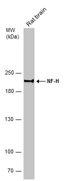Rat tissue extract (50 μg) was separated by 5% SDS-PAGE, and the membrane was blotted with NF-H antibody (GTX110065) diluted at 1:500.