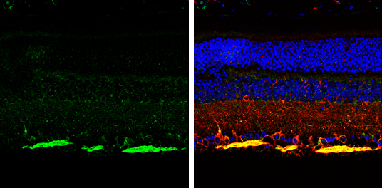 NF-H antibody detects NF-H protein expression by immunohistochemical analysis. Sample:Paraffin-Embedded adult mouse retina. Green: NF-H protein stained by NF-H antibody (GTX110065) diluted at 1:250. Red: beta Tubulin 3/ TUJ1, stained by beta Tubulin 3/ TUJ1 antibody [GT11710] (GTX631836) diluted at 1:500. Blue: Fluoroshield with DAPI (GTX30920).