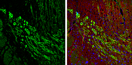 NF-H antibody detects NF-H protein expression by immunohistochemical analysis. Sample: Frozen-sectioned adult mouse cerebellum. Green: NF-H protein stained by NF-H antibody (GTX110065) diluted at 1:250. Red: beta Tubulin 3/ TUJ1, stained by beta Tubulin 3/ TUJ1 antibody [GT11710] (GTX631836) diluted at 1:500. Blue: Fluoroshield with DAPI (GTX30920).