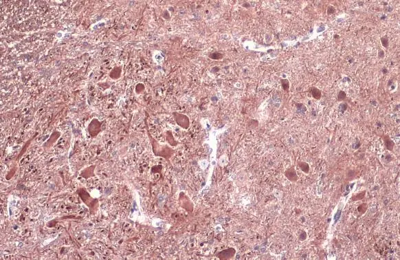 NF-H antibody detects NF-H protein at cytoplasm by immunohistochemical analysis. Sample: Paraffin-embedded mouse spinal cord. NF-H stained by NF-H antibody (GTX110065) diluted at 1:500. Antigen Retrieval: Citrate buffer, pH 6.0, 15 min