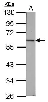 Vitamin D Binding Protein antibody