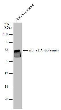 Human tissue extract (30 μg) was separated by 10% SDS-PAGE, and the membrane was blotted with alpha 2 Antiplasmin antibody [N3C3] (GTX110076) diluted at 1:2000.