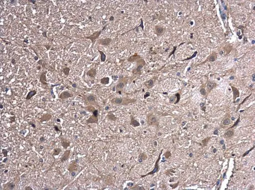 HSPA2 antibody detects HSPA2 protein at cytoplasm in rat brain by immunohistochemical analysis. Sample: Paraffin-embedded rat brain. HSPA2 antibody (GTX110079) diluted at 1:500. 
 Antigen Retrieval: Citrate buffer, pH 6.0, 15 min
