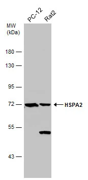 Various whole cell extracts (30 μg) were separated by 7.5% SDS-PAGE, and the membrane was blotted with HSPA2 antibody (GTX110079) diluted at 1:10000.