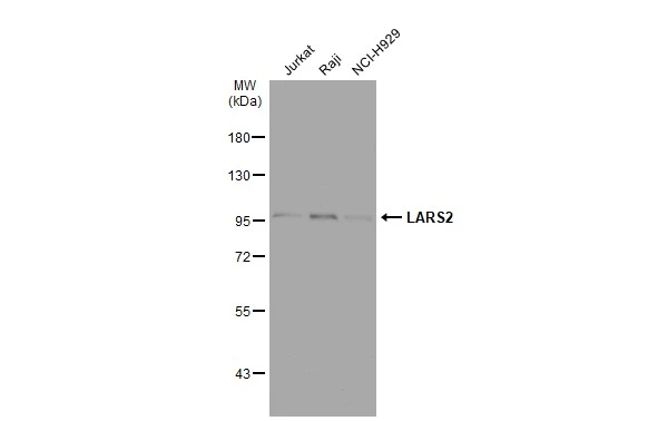 Various whole cell extracts (30 μg) were separated by 7.5% SDS-PAGE, and the membrane was blotted with LARS2 antibody [N2C1], Internal (GTX110083) diluted at 1:3000. The HRP-conjugated anti-rabbit IgG antibody (GTX213110-01) was used to detect the primary antibody.