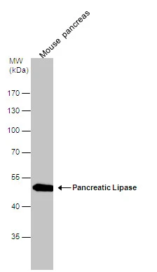 Pancreatic Lipase antibody [N3C3] detects Pancreatic Lipase protein by western blot analysis. Mouse tissue extracts (30 μg) was separated by 10% SDS-PAGE, and the membrane was blotted with Pancreatic Lipase antibody [N3C3] (GTX110086) diluted at 1:5000.