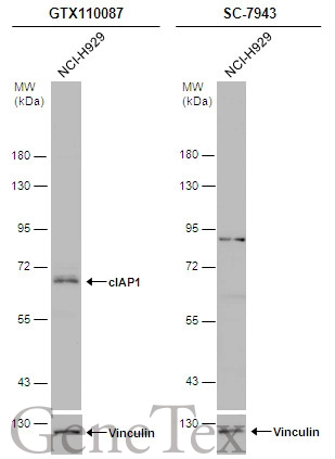 Whole cell extract (30 μg) was separated by 7.5% SDS-PAGE, and the membrane was blotted with cIAP1 antibody (GTX110087) diluted at 1:1000 and competitor's antibody (SC-7943) diluted by 1:200. The HRP-conjugated anti-rabbit IgG antibody (GTX213110-01) was used to detect the primary antibody.