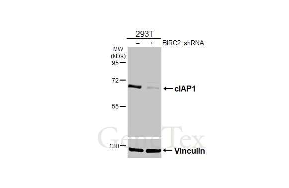 Non-transfected (–) and transfected (+) 293T whole cell extracts (50 μg) were separated by 7.5% SDS-PAGE, and the membrane was blotted with cIAP1 antibody (GTX110087) diluted at 1:500. The HRP-conjugated anti-rabbit IgG antibody (GTX213110-01) was used to detect the primary antibody.