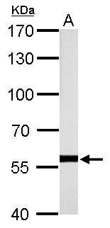 HSP60 antibody detects HSPD1 protein by western blot analysis. A. 50 ug rat brain lysate/extract 7.5% SDS-PAGE HSP60 antibody (GTX110089) dilution:1:10000 The HRP-conjugated anti-rabbit IgG antibody (GTX213110-01) was used to detect the primary antibody.