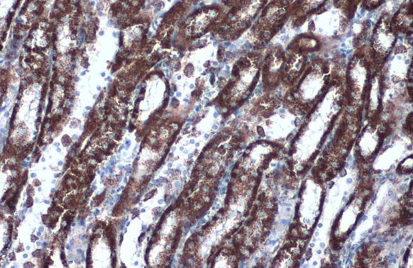 HSP60 antibody detects HSPD1 protein by western blot analysis. A. 50 ug rat brain lysate/extract 7.5% SDS-PAGE HSP60 antibody (GTX110089) dilution:1:10000 The HRP-conjugated anti-rabbit IgG antibody (GTX213110-01) was used to detect the primary antibody.