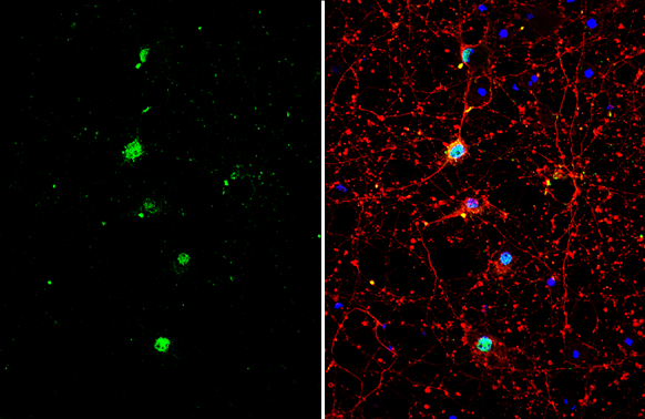 TLE1 antibody [N2C1], Internal detects TLE1 protein by immunofluorescent analysis. Sample: DIV10 rat E18 primary cortical neuron cells were fixed in 4% paraformaldehyde at RT for 15 min. Green: TLE1 stained by TLE1 antibody [N2C1], Internal (GTX110092) diluted at 1:500. Red: beta Tubulin 3/ Tuj1, stained by beta Tubulin 3/ Tuj1 antibody [GT11710] (GTX631836) diluted at 1:500. Blue: Fluoroshield with DAPI (GTX30920).