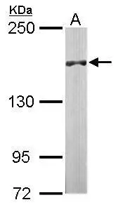 DIP2B antibody [C2C3-2], C-term