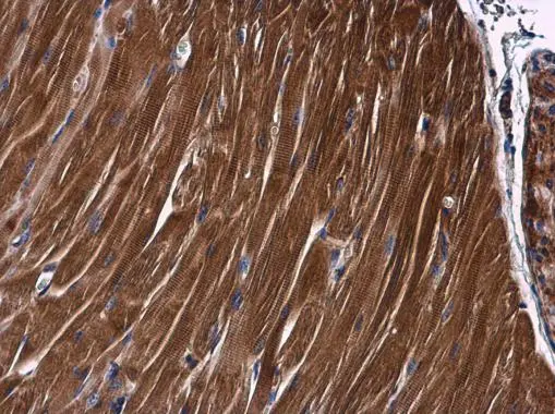 PKC theta antibody [N1N3-2] detects PKC theta protein at cytoplasm in mouse muscle by immunohistochemical analysis. Sample: Paraffin-embedded mouse muscle. PKC theta antibody [N1N3-2] (GTX110127) diluted at 1:500. 
 Antigen Retrieval: Citrate buffer, pH 6.0, 15 min