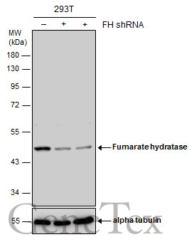 Fumarate hydratase antibody [N2C2], Internal
