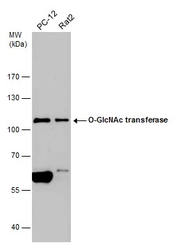 Various whole cell extracts (30 μg) were separated by 7.5% SDS-PAGE, and the membrane was blotted with O-GlcNAc transferase antibody [N1N2], N-term (GTX110136) diluted at 1:1000.