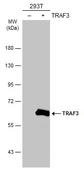 Non-transfected (–) and transfected (+) 293T whole cell extracts (30 μg) were separated by 7.5% SDS-PAGE, and the membrane was blotted with TRAF3 antibody [N1C1] (GTX110152) diluted at 1:5000. The HRP-conjugated anti-rabbit IgG antibody (GTX213110-01) was used to detect the primary antibody.