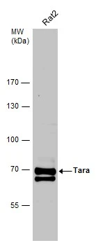Whole cell extract (30 μg) was separated by 7.5% SDS-PAGE, and the membrane was blotted with Tara antibody [C2C3-2], C-term (GTX110158) diluted at 1:5000. The HRP-conjugated anti-rabbit IgG antibody (GTX213110-01) was used to detect the primary antibody.