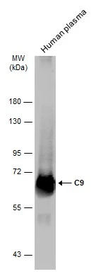 Human plasma (30 μg) was separated by 7.5% SDS-PAGE, and the membrane was blotted with C9 antibody [N2C2-2], Internal (GTX110161) diluted at 1:1000. The HRP-conjugated anti-rabbit IgG antibody (GTX213110-01) was used to detect the primary antibody.