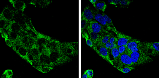 C9 antibody [N2C2-2], Internal detects C9 protein at by immunofluorescent analysis. Sample: HepG2 cells were fixed in 4% paraformaldehyde at RT for 15 min. Green: C9 stained by C9 antibody [N2C2-2], Internal (GTX110161) diluted at 1:500. Blue: Hoechst 33342 staining.