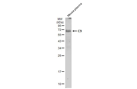 Mouse plasma (50 μg) was separated by 12% SDS-PAGE, and the membrane was blotted with C9 antibody [N2C2-2], Internal (GTX110161) diluted at 1:1000. The HRP-conjugated anti-rabbit IgG antibody (GTX213110-01) was used to detect the primary antibody, and the signal was developed with Trident ECL plus-Enhanced.