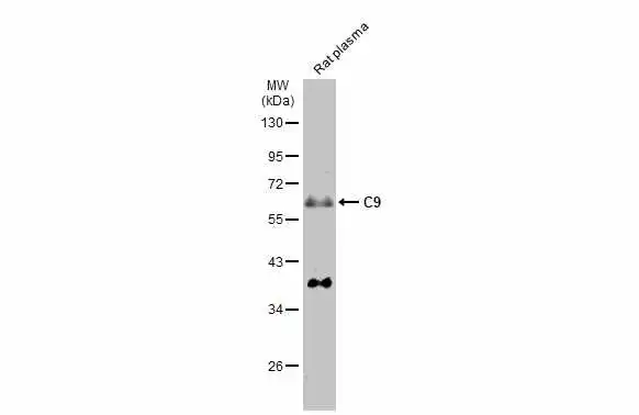 Rat plasma (50 μg) was separated by 10% SDS-PAGE, and the membrane was blotted with C9 antibody [N2C2-2], Internal (GTX110161) diluted at 1:1000. The HRP-conjugated anti-rabbit IgG antibody (GTX213110-01) was used to detect the primary antibody, and the signal was developed with Trident ECL plus-Enhanced.