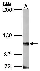 Sample (50 ug of whole cell lysate) A: Mouse brain 5% SDS PAGE GTX110166 diluted at 1:3000 Sample (50 ug of whole cell lysate) A: Mouse brain 5% SDS PAGE GTX110166 diluted at 1:3000