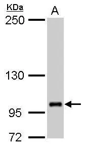 FOG2/ZFPM2 antibody detects ZFPM2 protein by Western blot analysis. A. 50 μg rat brain lysate/extract 5 % SDS-PAGE FOG2/ZFPM2 antibody (GTX110166) dilution: 1:1000