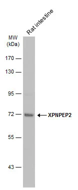 Rat tissue extract (50 ug) was separated by 7.5% SDS-PAGE,and the membrane was blotted with XPNPEP2 antibody [N2C2],Internal (GTX110170) diluted at 1:500.The HRP-conjugated anti-rabbit IgG antibody (GTX213110-01) was used to detect the primary antibody.